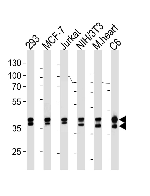 MAPK3 / ERK1 Antibody - Erk1/2 Antibody western blot of 293,MCF-7,Jurkat,mouse NIH/3T3,rat C6 cell line and mouse heart lysates (35 ug/lane). The Erk1/2 antibody detected the Erk1/2 protein (arrow).