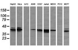 MAPK3 / ERK1 Antibody - Western blot of extracts (35ug) from 9 different cell lines by using anti-MAPK3 monoclonal antibody (HepG2: human; HeLa: human; SVT2: mouse; A549: human; COS7: monkey; Jurkat: human; MDCK: canine; PC12: rat; MCF7: human).