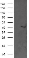 MAPK3 / ERK1 Antibody - HEK293T cells were transfected with the pCMV6-ENTRY control (Left lane) or pCMV6-ENTRY MAPK3 (Right lane) cDNA for 48 hrs and lysed. Equivalent amounts of cell lysates (5 ug per lane) were separated by SDS-PAGE and immunoblotted with anti-MAPK3.