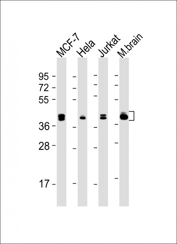 MAPK3 / ERK1 Antibody - All lanes: Anti-MAPK3/1 Antibody (Center) at 1:2000 dilution Lane 1: MCF-7 whole cell lysate Lane 2: Hela whole cell lysate Lane 3: Jurkat whole cell lysate Lane 4: mouse brain lysate Lysates/proteins at 20 µg per lane. Secondary Goat Anti-mouse IgG, (H+L), Peroxidase conjugated at 1/10000 dilution. Predicted band size: 43 kDa Blocking/Dilution buffer: 5% NFDM/TBST.
