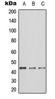 MAPK3 / ERK1 Antibody - Western blot analysis of ERK1 expression in A431 (A); NIH3T3 (B); PC12 (C) whole cell lysates.