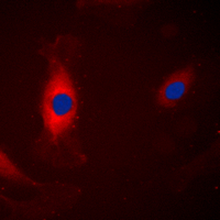 MAPK3 / ERK1 Antibody - Immunofluorescent analysis of ERK1 staining in A431 cells. Formalin-fixed cells were permeabilized with 0.1% Triton X-100 in TBS for 5-10 minutes and blocked with 3% BSA-PBS for 30 minutes at room temperature. Cells were probed with the primary antibody in 3% BSA-PBS and incubated overnight at 4 C in a humidified chamber. Cells were washed with PBST and incubated with a DyLight 594-conjugated secondary antibody (red) in PBS at room temperature in the dark. DAPI was used to stain the cell nuclei (blue).