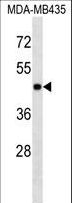 MAPK3 / ERK1 Antibody - MAPK3 Antibody western blot of MDA-MB435 cell line lysates (35 ug/lane). The MAPK3 antibody detected the MAPK3 protein (arrow).