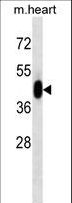 MAPK3 / ERK1 Antibody - MAPK3 Antibody western blot of mouse heart tissue lysates (35 ug/lane). The MAPK3 antibody detected the MAPK3 protein (arrow).