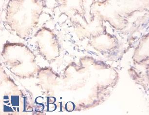 MAPK3 / ERK1 Antibody - Immunohistochemistry of paraffin-embedded human prostate using MAPK3 / ERK1 antibody at dilution of 1:100.  This image was taken for the unconjugated form of this product. Other forms have not been tested.