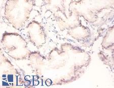 MAPK3 / ERK1 Antibody - Immunohistochemistry of paraffin-embedded human prostate using MAPK3 / ERK1 antibody at dilution of 1:100.  This image was taken for the unconjugated form of this product. Other forms have not been tested.