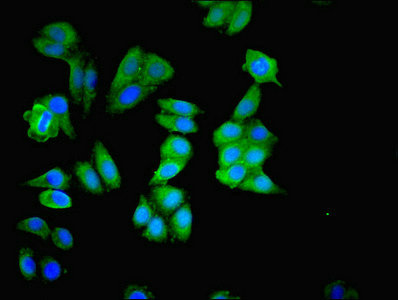 MAPK3 / ERK1 Antibody - Immunofluorescent analysis of HepG2 cells using MAPK3 Antibody at dilution of 1:100 and Alexa Fluor 488-congugated AffiniPure Goat Anti-Rabbit IgG(H+L)