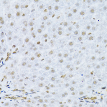 MAPK3 / ERK1 Antibody - Immunohistochemistry of paraffin-embedded human liver using MAPK3 Antibodyat dilution of 1:100 (40x lens).