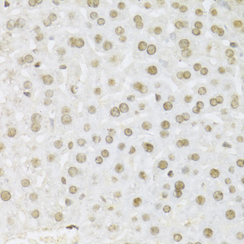 MAPK3 / ERK1 Antibody - Immunohistochemistry of paraffin-embedded mouse liver using MAPK3 Antibodyat dilution of 1:100 (40x lens).