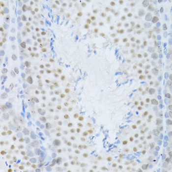 MAPK3 / ERK1 Antibody - Immunohistochemistry of paraffin-embedded mouse testis using MAPK3 Antibodyat dilution of 1:100 (40x lens).
