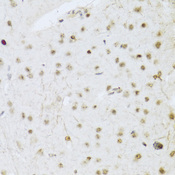 MAPK3 / ERK1 Antibody - Immunohistochemistry of paraffin-embedded mouse brain using MAPK3 Antibodyat dilution of 1:100 (40x lens).