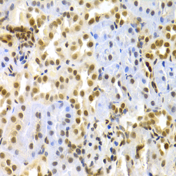 MAPK3 / ERK1 Antibody - Immunohistochemistry of paraffin-embedded rat kidney using MAPK3 Antibodyat dilution of 1:100 (40x lens).