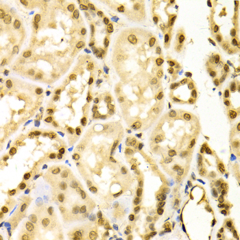 MAPK3 / ERK1 Antibody - Immunohistochemistry of paraffin-embedded human kidney using MAPK3 Antibodyat dilution of 1:100 (40x lens).