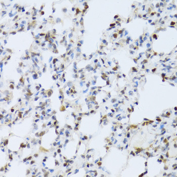 MAPK3 / ERK1 Antibody - Immunohistochemistry of paraffin-embedded rat lung using MAPK3 Antibodyat dilution of 1:100 (40x lens).