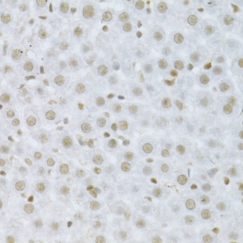 MAPK3 / ERK1 Antibody - Immunohistochemistry of paraffin-embedded rat liver using MAPK3 Antibodyat dilution of 1:100 (40x lens).