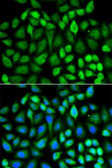 MAPK3 / ERK1 Antibody - Immunofluorescence analysis of U2OS cells using MAPK3 antibody. Blue: DAPI for nuclear staining.
