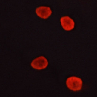 MAPK3 / ERK1 Antibody - Staining LOVO cells by IF/ICC. The samples were fixed with PFA and permeabilized in 0.1% saponin prior to blocking in 10% serum for 45 min at 37°C. The primary antibody was diluted 1/400 and incubated with the sample for 1 hour at 37°C. A Alexa Fluor® 594 conjugated goat polyclonal to rabbit IgG (H+L), diluted 1/600 was used as secondary antibody.
