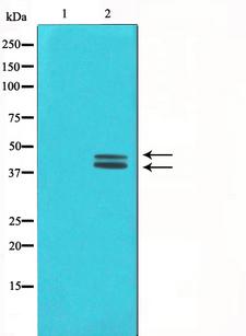 MAPK3 / ERK1 Antibody - Western blot analysis on COLO205 cell lysates using ERK1/2 antibody. The lane on the left is treated with the antigen-specific peptide.