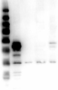 MAPK3 / ERK1 Antibody - Western Blot of rabbit Anti-ERK1 N-Term Antibody. Lane 1: Molecular weight marker. Lane 2: ERK1 double mutant WC Lysate. Lane 3: ERK2 protein. Lane 4: Mouse Brain WC Lysate. Lane 5: HEK293 WC Lysate. Load: 10ng lysate, 50ng protein. Blocking: Universal Blocking Buffer (MB-073) for 30 min RT. Primary antibody: Anti-ERK1 N-Term at 1µg/mL in MB-073overnight at 4°C. Secondary antibody: Goat anti-Rabbit HRP 1:40,000 in MB-073 for 30 min at RT. Expect: ~43kDa.