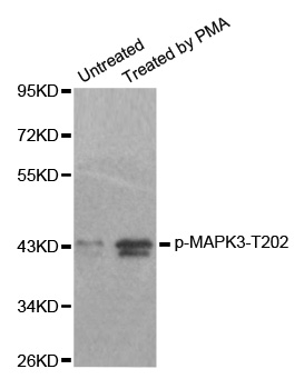 MAPK3 / ERK1 Antibody - Western blot analysis of extracts from 293 cells.