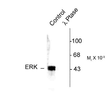 MAPK3 / ERK1 Antibody - Western blot of human T47D cell lysates showing specific immunolabeling of ~42-44k ERK/MAPK protein phosphorylated at Thr202 and Tyr204 (Control). The phosphospecificity of this labeling is shown in the second lane (lambda-phosphatase: lambda phosphatase)