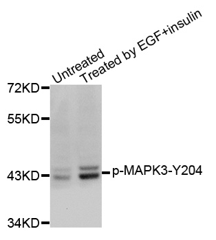MAPK3 / ERK1 Antibody - Western blot analysis of extracts from SK-BR-3 cells.