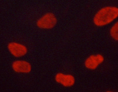 MAPK3 / ERK1 Antibody - Staining LOVO cells by IF/ICC. The samples were fixed with PFA and permeabilized in 0.1% saponin prior to blocking in 10% serum for 45 min at 37°C. The primary antibody was diluted 1/400 and incubated with the sample for 1 hour at 37°C. A Alexa Fluor® 594 conjugated goat polyclonal to rabbit IgG (H+L), diluted 1/600 was used as secondary antibody.