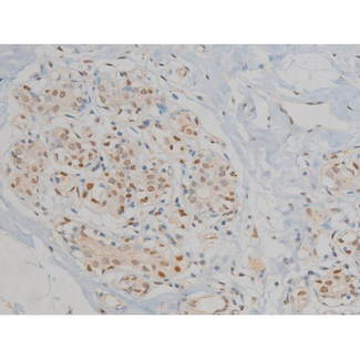 MAPK3 / ERK1 Antibody - 1:200 staining human heart tissue by IHC-P. The tissue was formaldehyde fixed and a heat mediated antigen retrieval step in citrate buffer was performed. The tissue was then blocked and incubated with the antibody for 1.5 hours at 22°C. An HRP conjugated goat anti-rabbit antibody was used as the secondary.