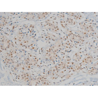 MAPK3 / ERK1 Antibody - 1:200 staining human heart tissue by IHC-P. The tissue was formaldehyde fixed and a heat mediated antigen retrieval step in citrate buffer was performed. The tissue was then blocked and incubated with the antibody for 1.5 hours at 22°C. An HRP conjugated goat anti-rabbit antibody was used as the secondary.