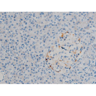 MAPK3 / ERK1 Antibody - 1:200 staining human pancreas tissue by IHC-P. The tissue was formaldehyde fixed and a heat mediated antigen retrieval step in citrate buffer was performed. The tissue was then blocked and incubated with the antibody for 1.5 hours at 22°C. An HRP conjugated goat anti-rabbit antibody was used as the secondary.