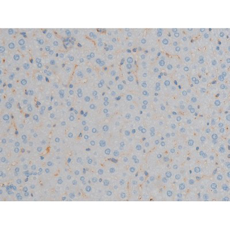 MAPK3 / ERK1 Antibody - 1:200 staining mouse liver tissue by IHC-P. The tissue was formaldehyde fixed and a heat mediated antigen retrieval step in citrate buffer was performed. The tissue was then blocked and incubated with the antibody for 1.5 hours at 22°C. An HRP conjugated goat anti-rabbit antibody was used as the secondary.