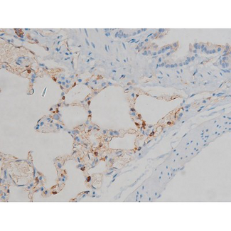 MAPK3 / ERK1 Antibody - 1:200 staining rat lung tissue by IHC-P. The tissue was formaldehyde fixed and a heat mediated antigen retrieval step in citrate buffer was performed. The tissue was then blocked and incubated with the antibody for 1.5 hours at 22°C. An HRP conjugated goat anti-rabbit antibody was used as the secondary.