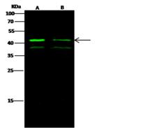 MAPK3 / ERK1 Antibody - Anti-MAPK3 rabbit polyclonal antibody at 1:500 dilution. Lane A: Jurkat Whole Cell Lysate. Lane B: K562 Whole Cell Lysate. Lysates/proteins at 30 ug per lane. Secondary: Goat Anti-Rabbit IgG H&L (Dylight 800) at 1/10000 dilution. Developed using the Odyssey technique. Performed under reducing conditions. Predicted band size: 43 kDa. Observed band size: 43 kDa. (We are unsure as to the identity of these extra bands.)
