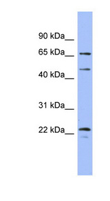 MAPK4 / ERK4 Antibody - MAPK4 antibody Western blot of Fetal Heart lysate. This image was taken for the unconjugated form of this product. Other forms have not been tested.