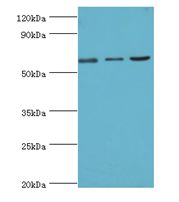 MAPK4 / ERK4 Antibody - Western blot. All lanes: MAPK4 antibody at 6 ug/ml. Lane 1: mouse brain tissue. Lane 2: 293T whole cell lysate. Lane 3: Jurkat whole cell lysate. Secondary antibody: Goat polyclonal to rabbit at 1:10000 dilution. Predicted band size: 66 kDa. Observed band size: 66 kDa.