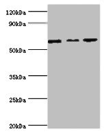 MAPK4 / ERK4 Antibody - Western blot All lanes: MAPK4 ntibody at 6µg/ml Lane 1: Mouse brain tissue Lane 2: 293T whole cell lysate Lane 3: Jurkat whole cell lysate Secondary Goat polyclonal to rabbit IgG at 1/10000 dilution Predicted band size: 66 kDa Observed band size: 66 kDa