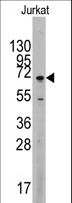 MAPK4 / ERK4 Antibody - Western blot of anti-MAPK4 Antibody in Jurkat cell line lysates (35 ug/lane). MAPK4(arrow) was detected using the purified antibody.