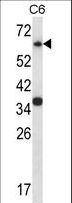 MAPK4 / ERK4 Antibody - Mouse Mapk4 Antibody western blot of C6 cell line lysates (35 ug/lane). The Mapk4 antibody detected the Mapk4 protein (arrow).