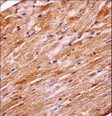 MAPK4 / ERK4 Antibody - Mouse Mapk4 Antibody immunohistochemistry of formalin-fixed and paraffin-embedded mouse heart tissue followed by peroxidase-conjugated secondary antibody and DAB staining.