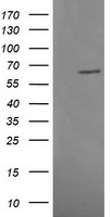 MAPK4 / ERK4 Antibody - HEK293T cells were transfected with the pCMV6-ENTRY control (Left lane) or pCMV6-ENTRY MAPK4 (Right lane) cDNA for 48 hrs and lysed. Equivalent amounts of cell lysates (5 ug per lane) were separated by SDS-PAGE and immunoblotted with anti-MAPK4.