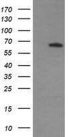 MAPK4 / ERK4 Antibody - HEK293T cells were transfected with the pCMV6-ENTRY control (Left lane) or pCMV6-ENTRY MAPK4 (Right lane) cDNA for 48 hrs and lysed. Equivalent amounts of cell lysates (5 ug per lane) were separated by SDS-PAGE and immunoblotted with anti-MAPK4.