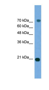 MAPK6 / ERK3 Antibody - MAPK6 antibody Western blot of Transfected 293T cell lysate. This image was taken for the unconjugated form of this product. Other forms have not been tested.
