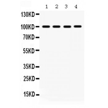 MAPK6 / ERK3 Antibody - MAPK6 antibody Western blot. All lanes: Anti MAPK6 at 0.5 ug/ml. Lane 1: Rat Brain Tissue Lysate at 50 ug. Lane 2: Rat Skeletal Muscle Tissue Lysate at 50 ug. Lane 3: PANC Whole Cell Lysate at 40 ug. Lane 4: NIH3T3 Whole Cell Lysate at 40 ug. Predicted band size: 68 kD. Observed band size: 100 kD.