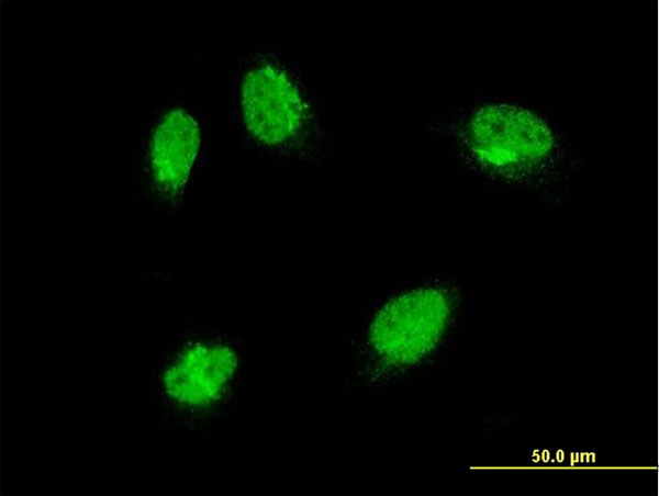 MAPK6 / ERK3 Antibody - Immunofluorescence of monoclonal antibody to MAPK6 on HeLa cell . [antibody concentration 10 ug/ml]