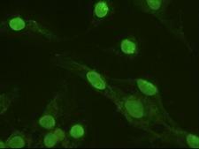 MAPK6 / ERK3 Antibody - Anti-MAPK6 mouse monoclonal antibody  immunofluorescent staining of HeLa cells transiently transfected by pCMV6-ENTRY MAPK6.