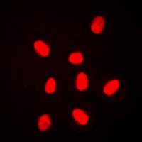MAPK6 / ERK3 Antibody - Immunofluorescent analysis of ERK3 staining in HeLa cells. Formalin-fixed cells were permeabilized with 0.1% Triton X-100 in TBS for 5-10 minutes and blocked with 3% BSA-PBS for 30 minutes at room temperature. Cells were probed with the primary antibody in 3% BSA-PBS and incubated overnight at 4 C in a humidified chamber. Cells were washed with PBST and incubated with a DyLight 594-conjugated secondary antibody (red) in PBS at room temperature in the dark. DAPI was used to stain the cell nuclei (blue).