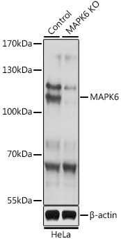 MAPK6 / ERK3 Antibody - Western blot analysis of extracts from normal (control) and MAPK6 knockout (KO) HeLa cells, using MAPK6 antibody at 1:1000 dilution. The secondary antibody used was an HRP Goat Anti-Rabbit IgG (H+L) at 1:10000 dilution. Lysates were loaded 25ug per lane and 3% nonfat dry milk in TBST was used for blocking. An ECL Kit was used for detection and the exposure time was 3s.