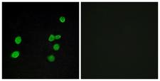 MAPK6 / ERK3 Antibody - Peptide - + Immunofluorescence analysis of MCF-7 cells, using p97 MAPK antibody.