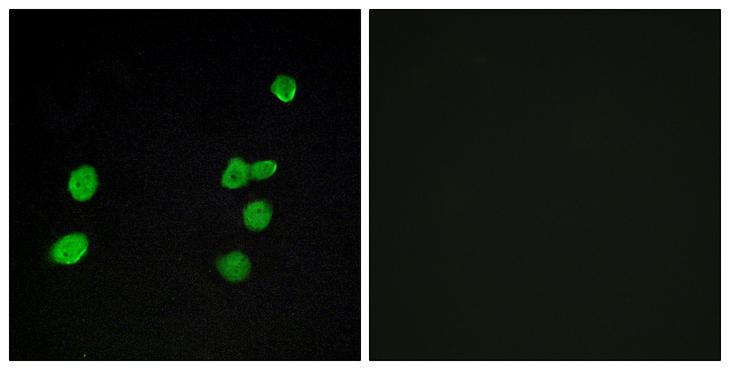 MAPK6 / ERK3 Antibody - Peptide - + Immunofluorescence analysis of MCF-7 cells, using p97 MAPK antibody.