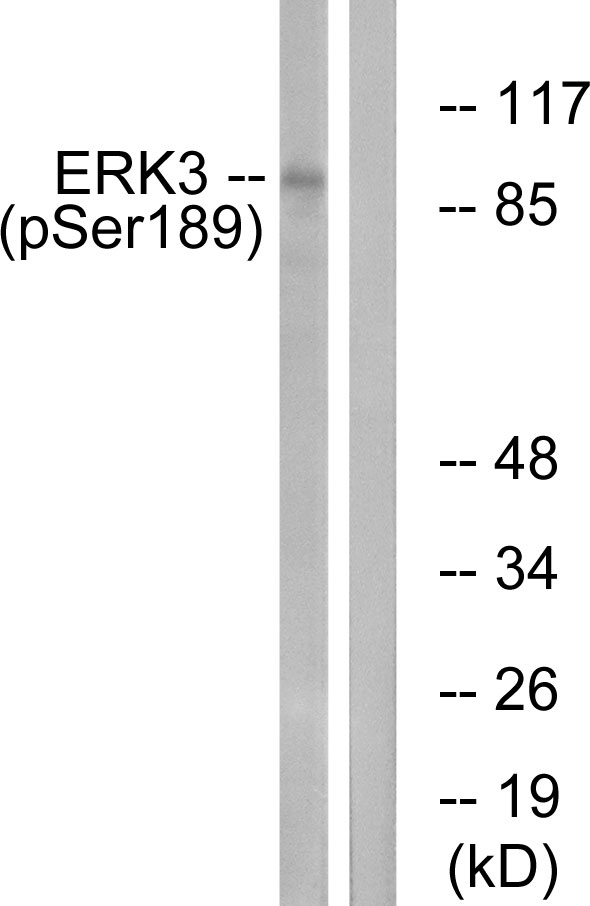 MAPK6 / ERK3 Antibody - Western blot analysis of lysates from mouse brain, using ERK3 (Phospho-Ser189) Antibody. The lane on the right is blocked with the phospho peptide.